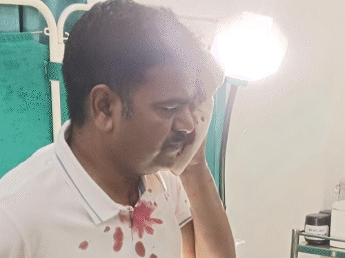चतरा में बंधकों को छुड़ाने गई पुलिस पर पथराव:थाना प्रभारी गंभीर घायल, सिर में लगे टांके; भीड़ को काबू करने हवाई फायरिंग