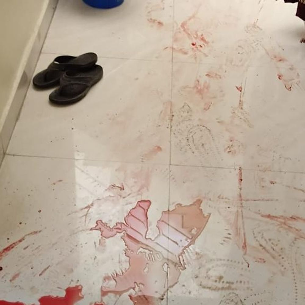 भोपाल के अवधपुरी में बुजुर्ग पर हथौड़ी से हमला:घर में घुसे 2 बदमाशों को देखकर किया विरोध, AIIMS में भर्ती; पुलिस जांच में जुटी