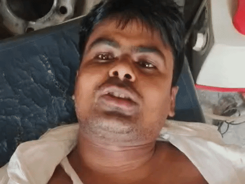 औरंगाबाद- सीएसपी संचालक को गोली मारकर 3 लाख की लूट:बाइक सवार अपराधियों ने ओवरटेक कर रोका, जांघ में लगी बुलेट; लैपटॉप समेत अन्य सामान ले भागे
