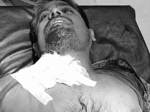 भोजपुर में लूट के दौरान ज्वेलरी कारोबारी को मारी गोली:दुकान बंद कर लौट रहे थे, पीछा कर गर्दन में दागी बुलेट; गहनों से भरा बैग ले भागे