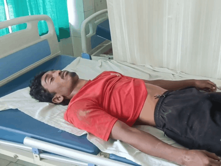 बिजली पोल शिफ्टिंग के दौरान करंट से 2 की मौत:जशपुर में 7 मजदूर चपेट में आए, दो गंभीर रूप से झुलसे,तीन की हालत सामान्य