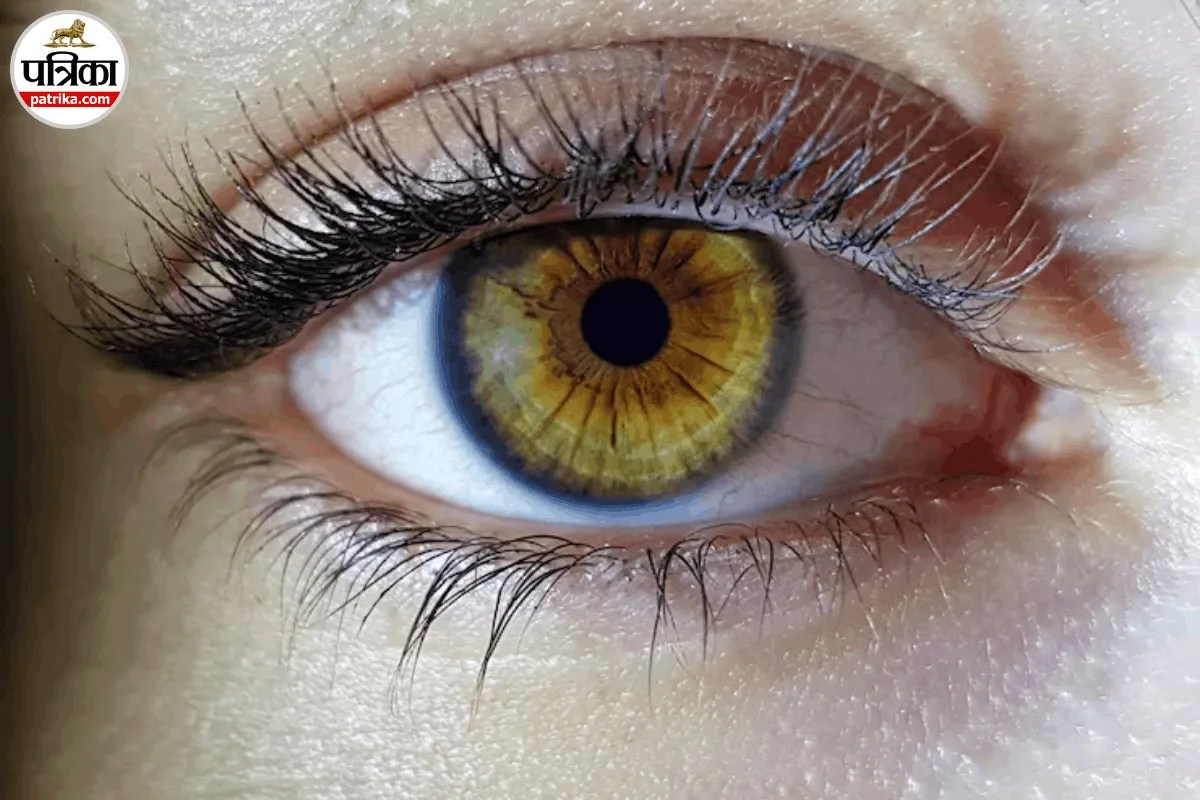 चश्मा पहनने वाले या मोतियाबिंद की सर्जरी करा चुके लोग Eye Donation नहीं कर सकते? AIIMS से जानें मिथक और सच्चाई