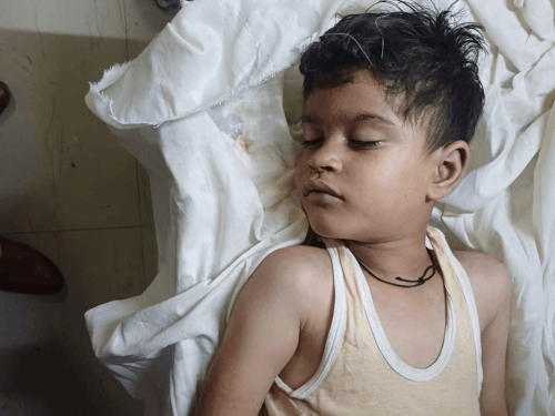 मंडी में सांप के डसने से मासूम भाई-बहन की मौत:पेट दर्द की शिकायत पर परिजनों ने किया उपचार, सांप देखने के बाद अस्पताल लेकर भागे