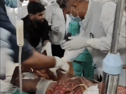 पटाखा फैक्ट्री ब्लास्ट में घायल अब खतरे से बाहर:SRN में 3 मरीजों इलाज जारी, मलबे में दबकर हुए थे जख्मी
