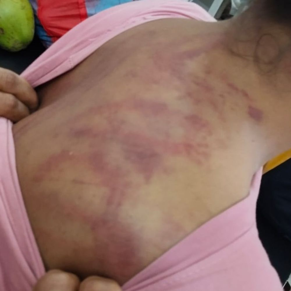 औरंगाबाद में जमीन विवाद में महिला से मारपीट:घर में घुसकर धमकी देने का आरोप, 2018 से कोर्ट में चल रहा मामला