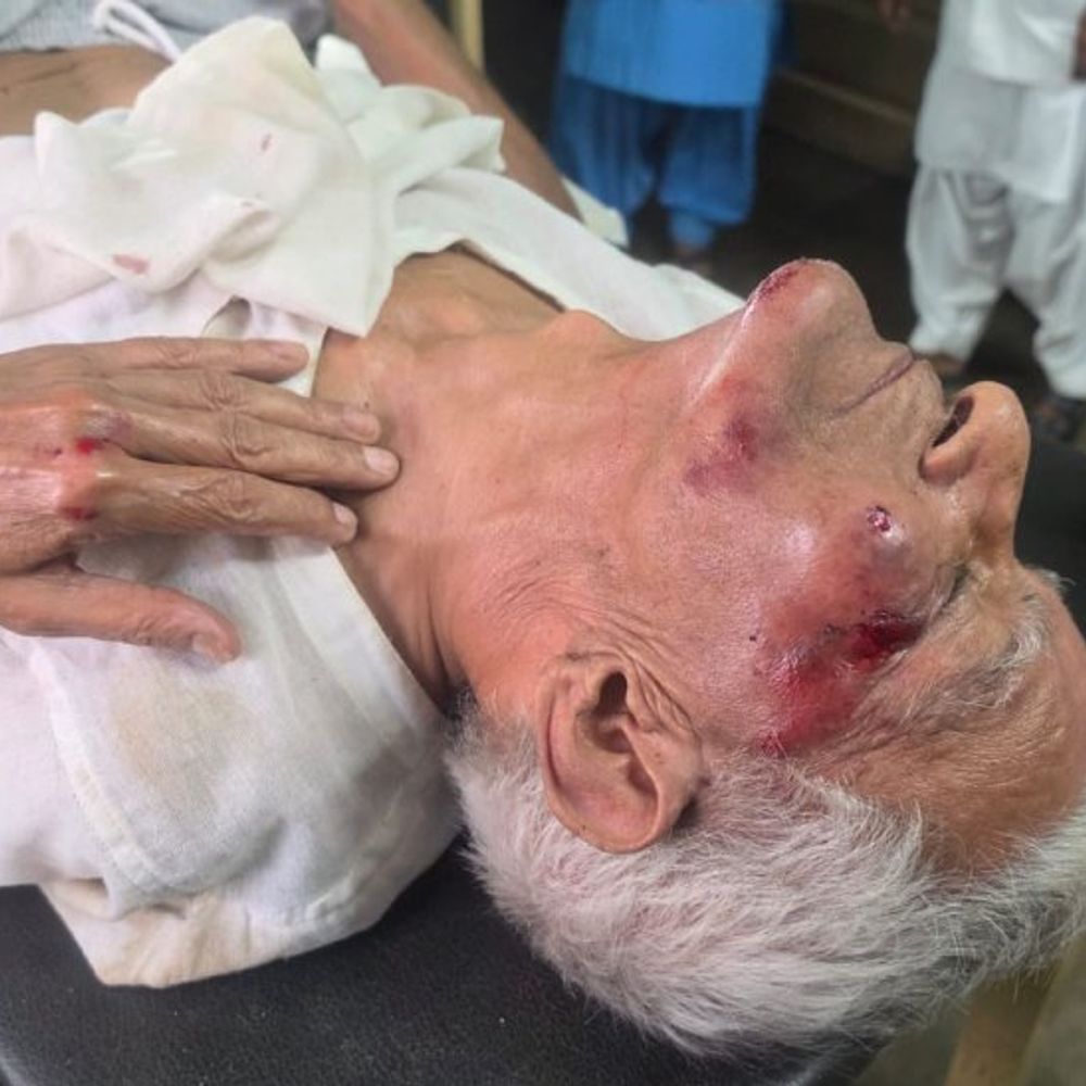 मेरठ में जाम के बहाने पूर्व नौसेना अधिकारी से लूटपाट:जिला अस्पताल से लौटते वक्त हुई वारदात, मोबाइल और 10 हजार रुपये लूटने का आरोप