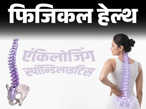 फिजिकल हेल्थ- कमर में दर्द को इग्नोर न करें:हो सकता है एंकिलोजिंग स्पॉन्डिलाइटिस, डॉक्टर से जानें इसके लक्षण और बचाव के तरीके