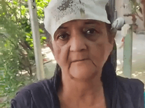 जालंधर के गढ़ा में दामाद का ससुराल वालो पर हमला:जबरन घर में घुसकर गंडासे से किया जानलेवा हमला, पत्नी, सास और साले को पीटा