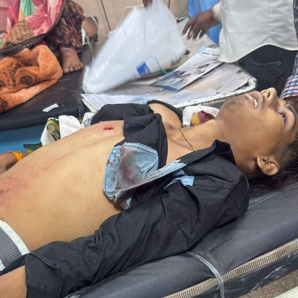 इंदौर में गणेश जुलूस में नाबालिगों पर चाकू से हमला:एक की मौत; दूसरा ICU में भर्ती, तेजाजी नगर से जुलूस में शामिल होने पहुंचे थे