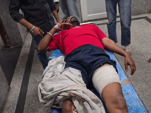 घर में घुसकर पड़ोसी पर चाकू-डंडों से हमला:जांघ और हाथ में गंभीर घाव, हॉस्पिटल में भर्ती; मामूली बात पर हुआ था विवाद