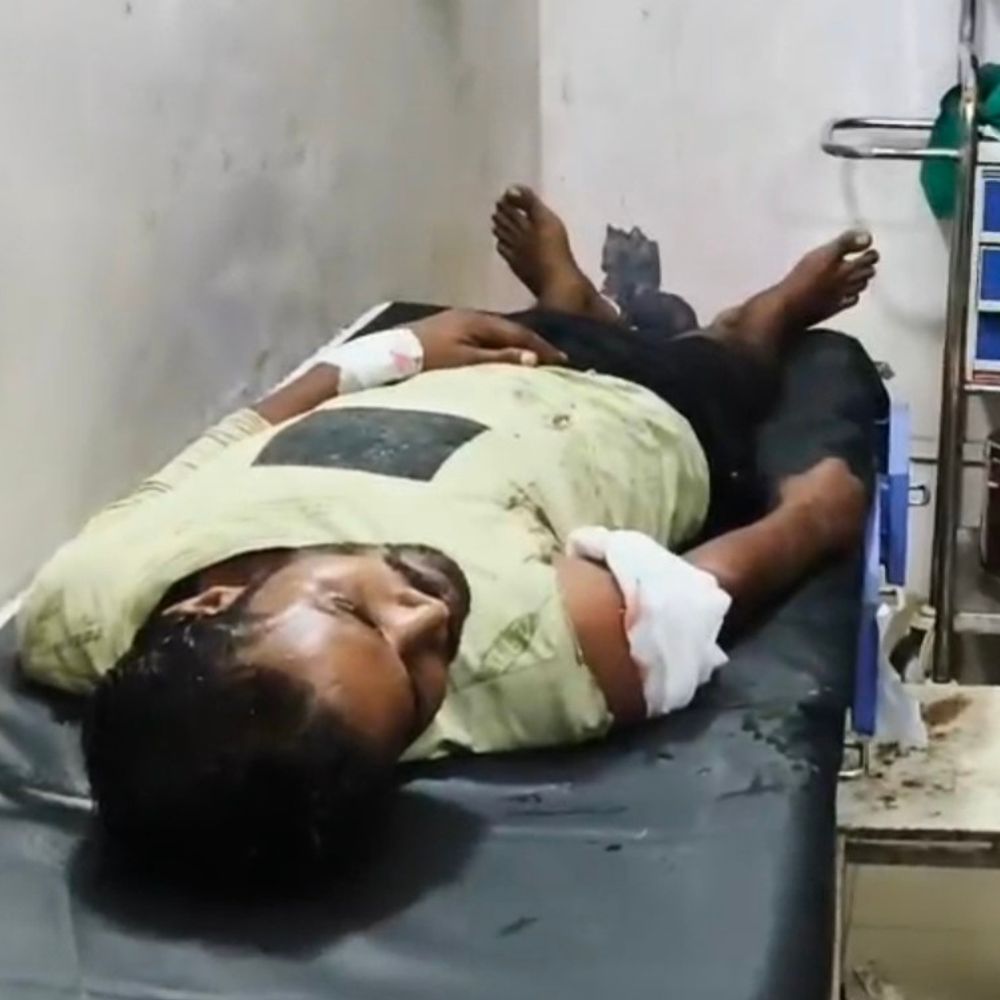 जमीन विवाद में ऑटो ड्राइवर पर फायरिंग, सदर अस्पताल रेफर:बांका में सवारी उतारने के बाद बदमाशों ने हाथ में मारी गोली, FIR दर्ज