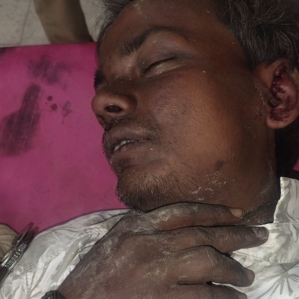 दरभंगा- पत्नी की हत्या का आरोपी ससुराल में बेसुध मिला:पुलिस अभिरक्षा में DMCH में इलाज, मारपीट के आरोप; होश आने पर कानूनी कार्रवाई होगी