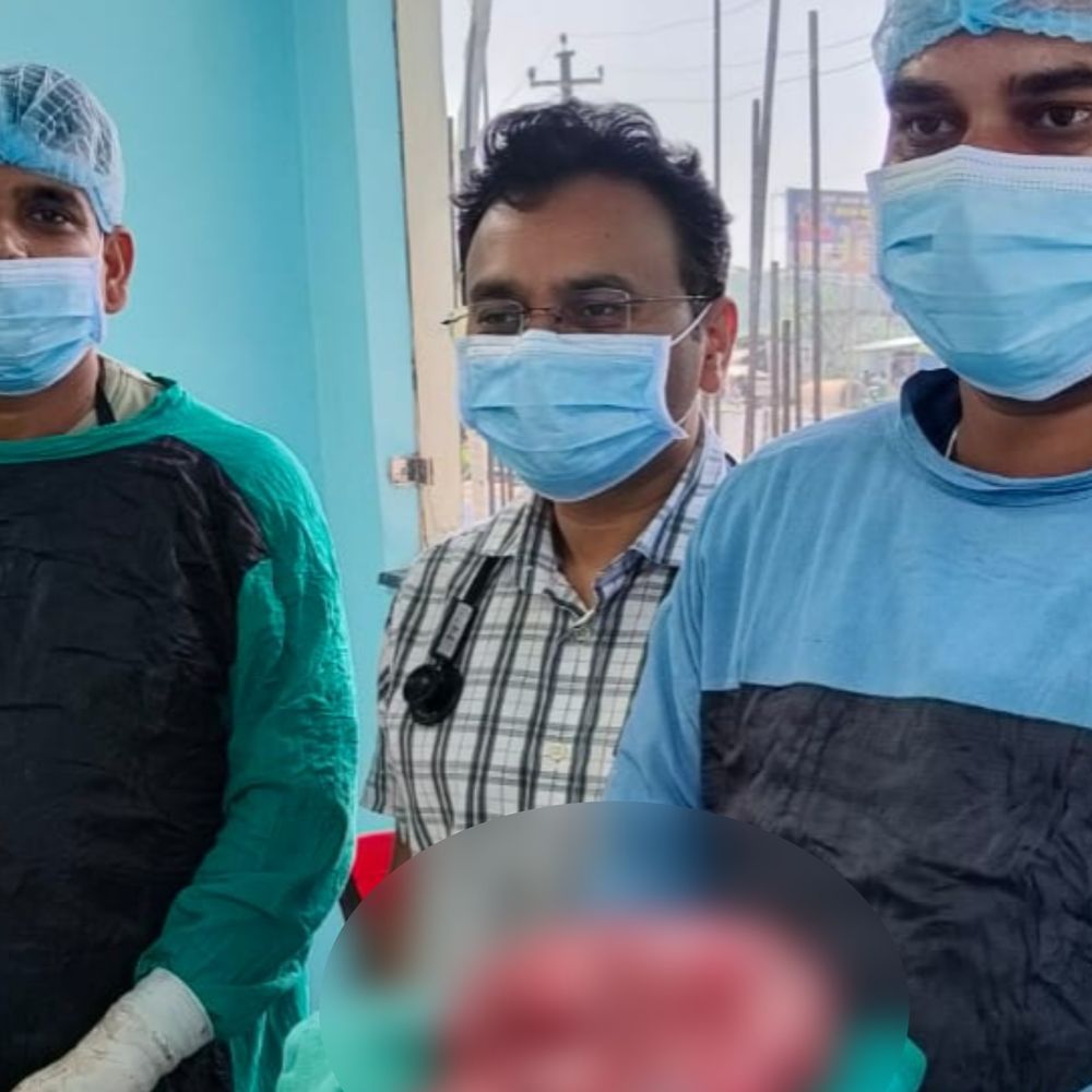 मधेपुरा में महिला के पेट से निकला 5KG का ट्यूमर:10 साल से झेल रही थी दर्द, छाती तक बढ़ गया था यूट्रस का आकार; 4 घंटे चला ऑपरेशन