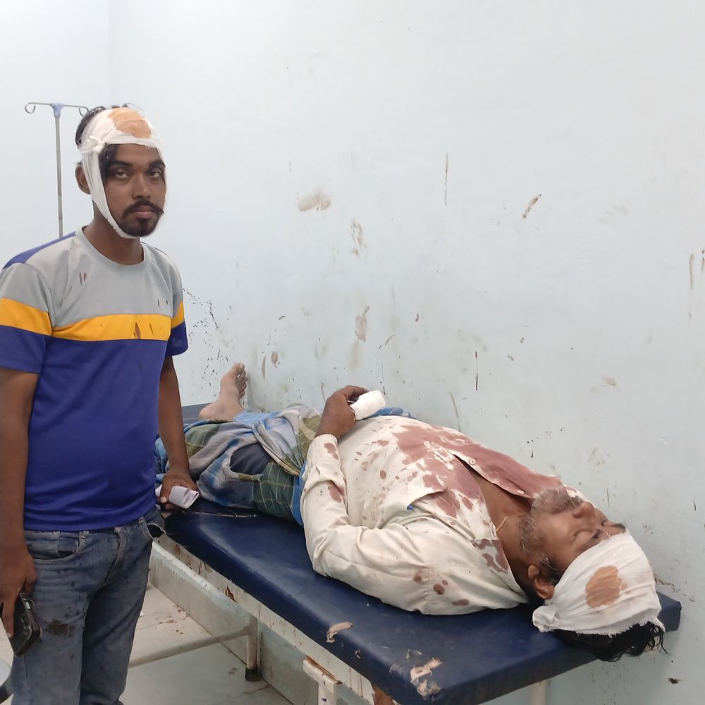 गोपालगंज में जमीन विवाद में पिता-बेटा गंभीर घायल:लाठी-डंडों से हमला, दोनों की हालत नाजुक; सदर अस्पताल रेफर