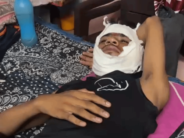 मोबाइल पर बात कर रहे छात्र पर चाकू से हमला:पड़ोसी ने चाकू से किए वार, चेहरा और सिर पर घाव, हत्या की धमकी देकर भागा