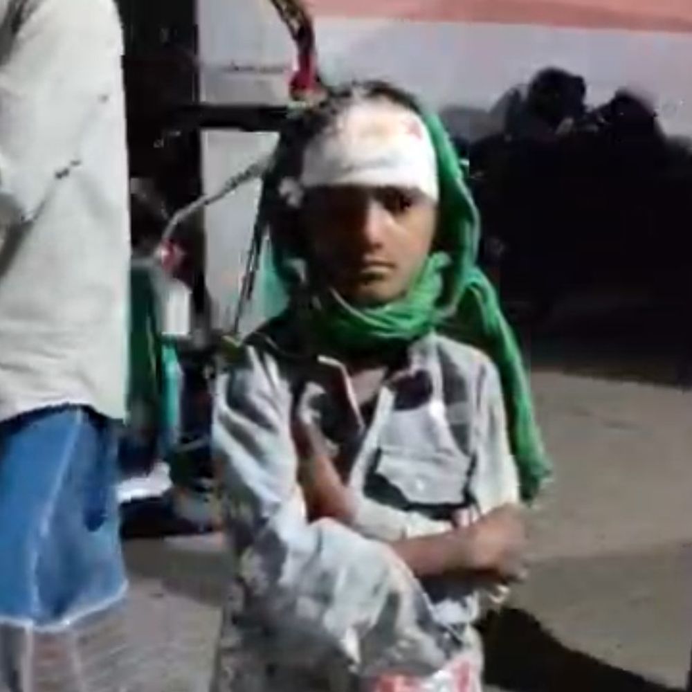 बेतिया में अज्ञात वाहन की टक्कर से बच्चे की मौत:दो सगे भाई घायल, आठ भाई-बहनों में पांचवें नंबर पर था मृतक