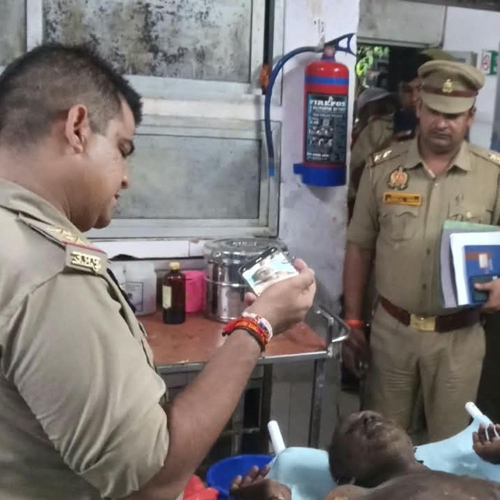 भाई से विवाद, युवक ने खुद को आग लगाई:औरैया में फांसी लगाने की भी कोशिश की; एसडीएम ने बयान दर्ज किए