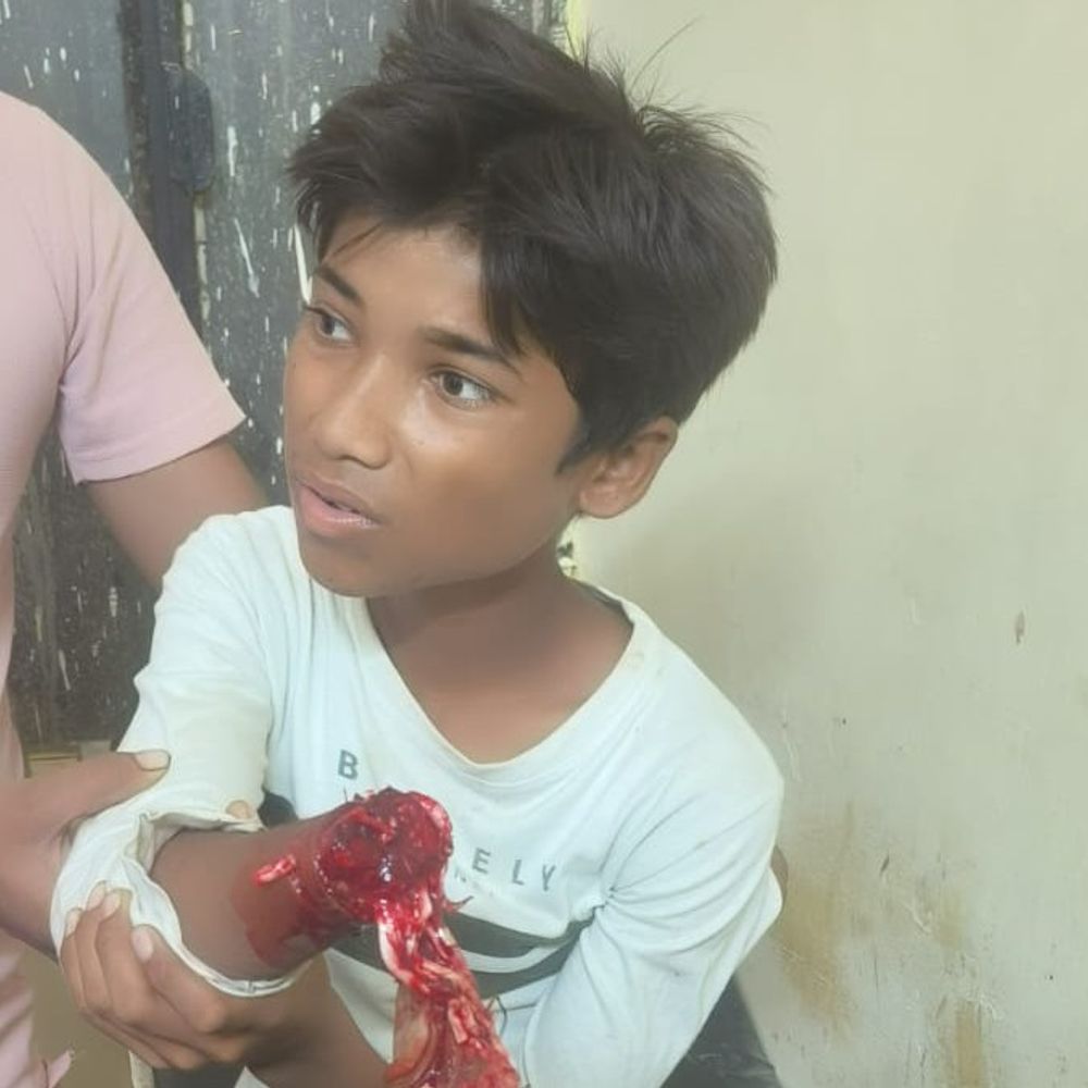 जालौन में मशीन की चपेट में आया किशोर:चारा काटते समय इलेक्ट्रिक मशीन में फंसा हाथ कटा, हालत नाजुक