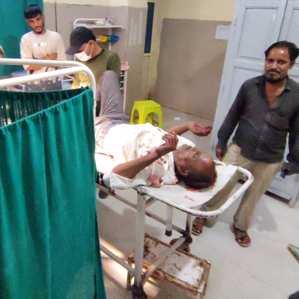 शाजापुर में बाइक के सामने आया जंगली सूअर:बाइक सवार गंभीर घायल; डायल-112 ने पहुंचाया अस्पताल, काम खत्म कर गांव लौट रहे थे