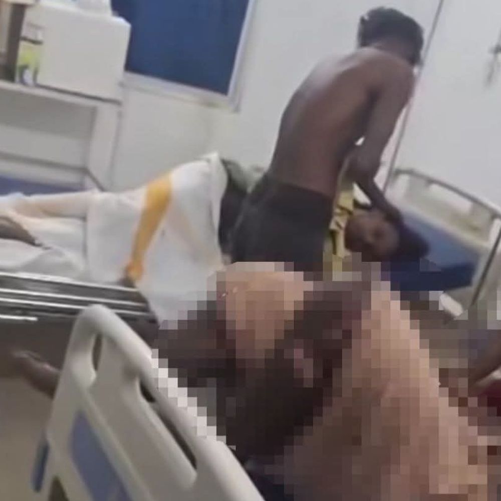 पूजा-पंडाल में नाटक मंचन से पहले लगी आग, 12 झुलसे:बैकस्टेज भूत की एंट्री की तैयारी के दौरान हादसा; जलता पर्दा गिरा, तब लोगों को पता चला