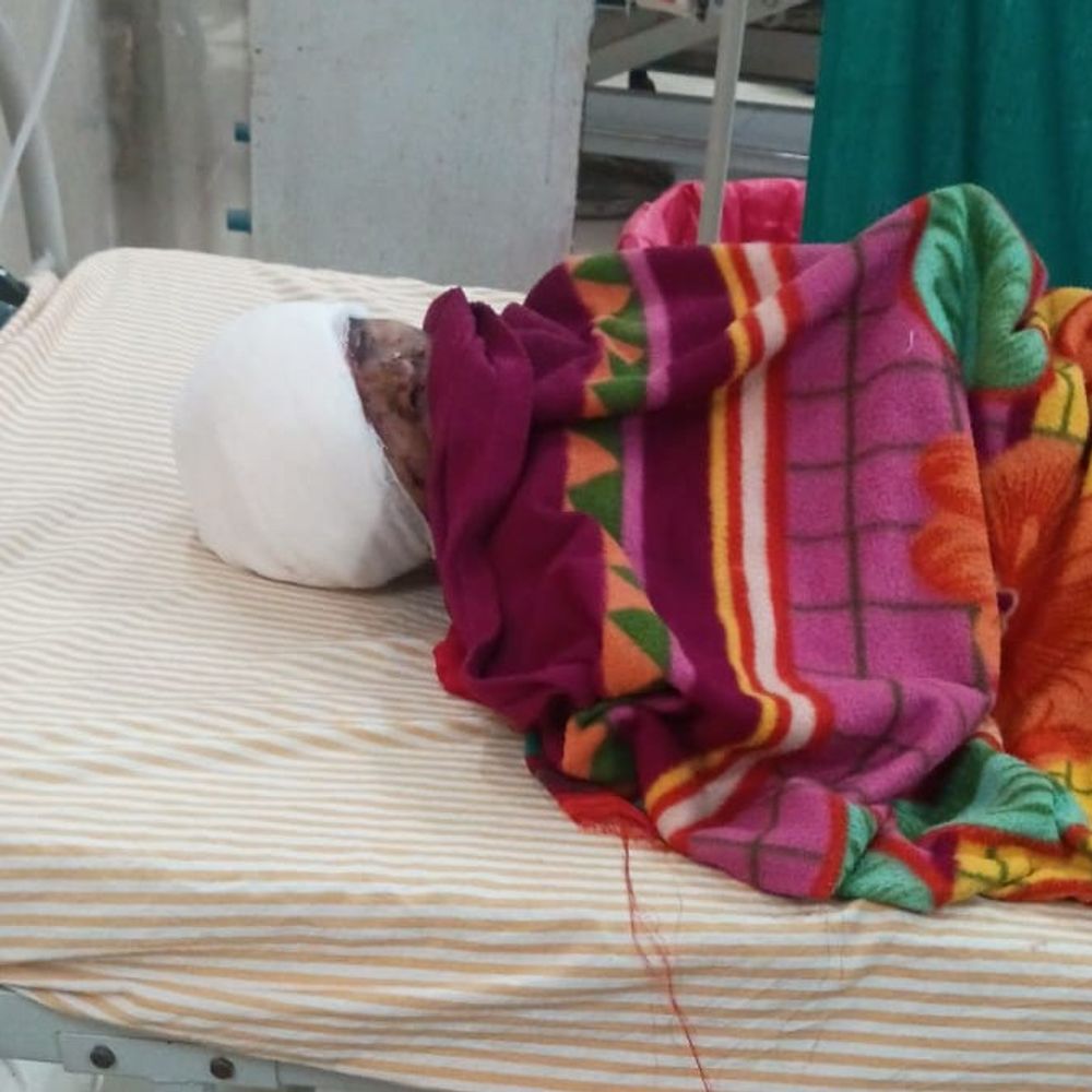 देवरिया में धान मड़ाई के दौरान थ्रेसर से महिला घायल:सिर में गंभीर चोट, गोरखपुर मेडिकल कालेज रेफर