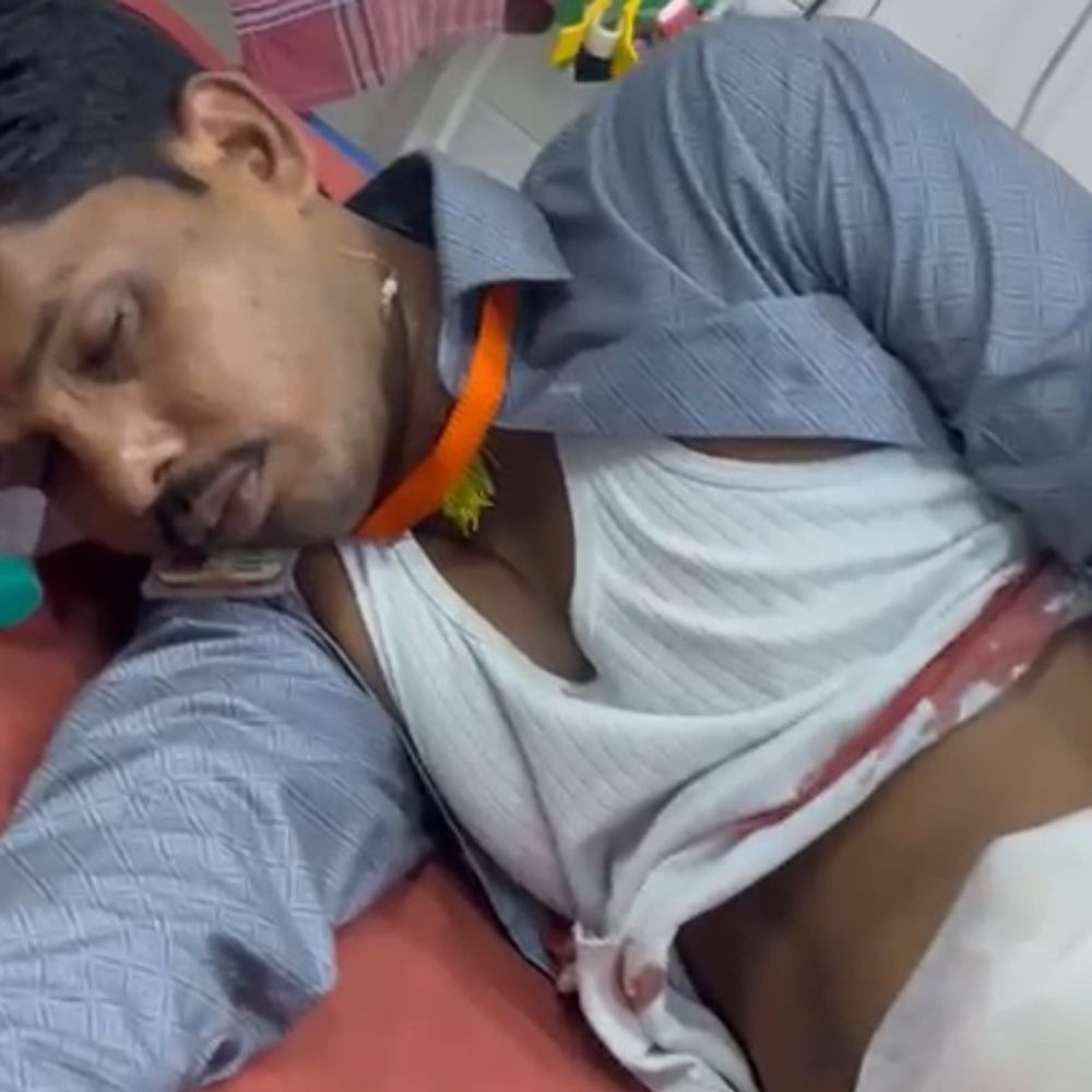 जौनपुर में विसर्जन के दौरान चाकूबाजी, युवक घायल:पेट में फंसा चाकू, गंभीर हालत में वाराणसी हुआ रेफर