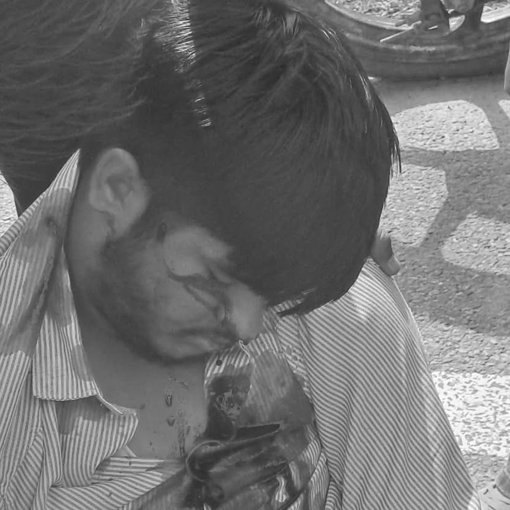 सांपला में पिकअप की टक्कर से दिल्ली का युवक घायल:बाइक पर सवार होकर जा रहा, मोटरसाइकिल की आरसी से हुई पहचान