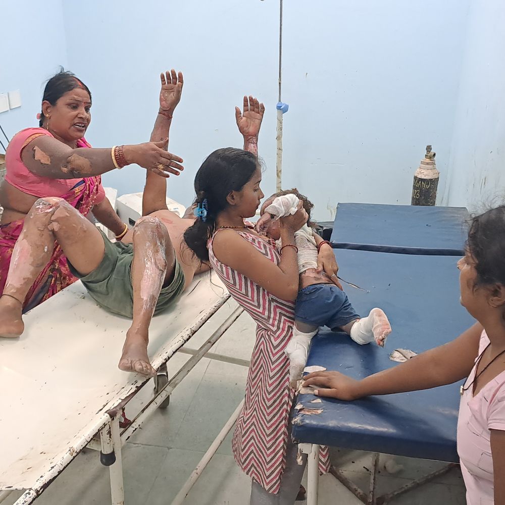 गोपालगंज में खाना बनाते समय गैस सिलेंडर में आग लगी:सफियाबाद गांव में मासूम समेत 16 लोग झुलसे, अस्पताल में भर्ती