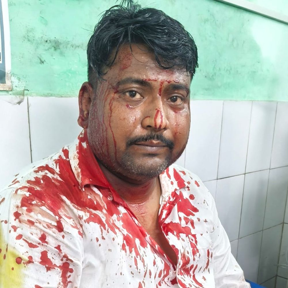 काकोरी में प्रॉपर्टी डीलर पर लोहे की रॉड से हमला:लाठी-डंडों से भी पीटा, कार में तोड़फोड़ की; कई लोगों पर साजिश का आरोप