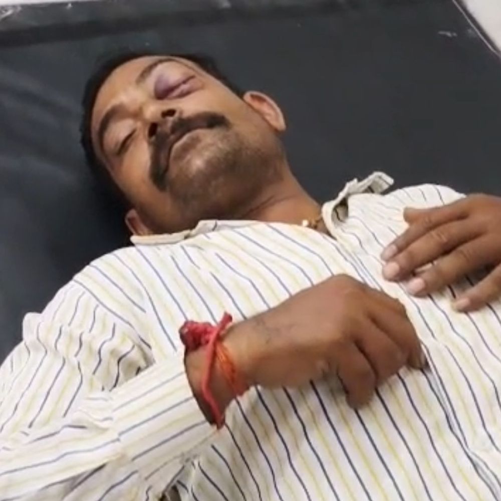 मैहर में वेयरहाउस के गार्ड को तीन युवकों ने पीटा:डंडे मारे, आंख, सिर और पैर में चोट, सहकर्मी को लूलू-लहान हालत में मिला