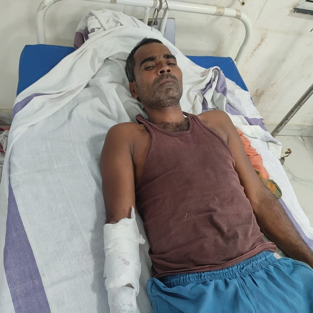 सीवान में देसी कट्टा से ट्रैक्टर मालिक पर फायरिंग:खेत में ट्रैक्टर खड़ा करने पर हुआ विवाद, दोनों पैरों में 12 छर्रे फंसे