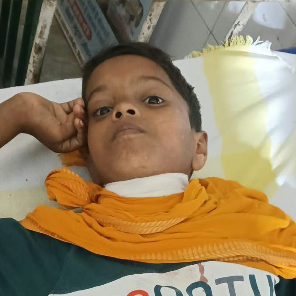 8 साल के बच्चे पर धारदार हथियार से वार:गर्दन जख्मी, NMCH में इलाज जारी; गोपालपुर में मकान मालिक ने शराब के नशे में किया हमला