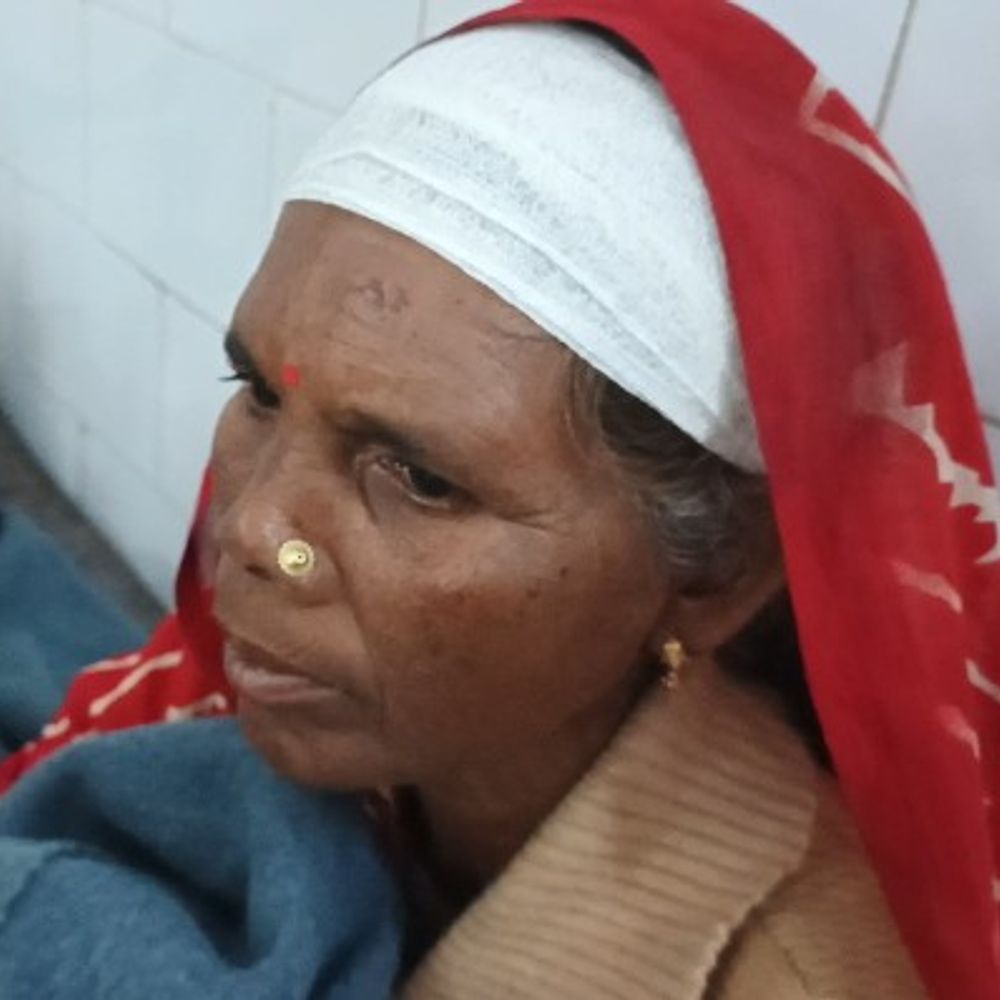 पन्ना में चलती बाइक से गिरकर महिला घायल:मनकी गांव जाते समय गिरी; सिर, हाथ और पैरों में चोट