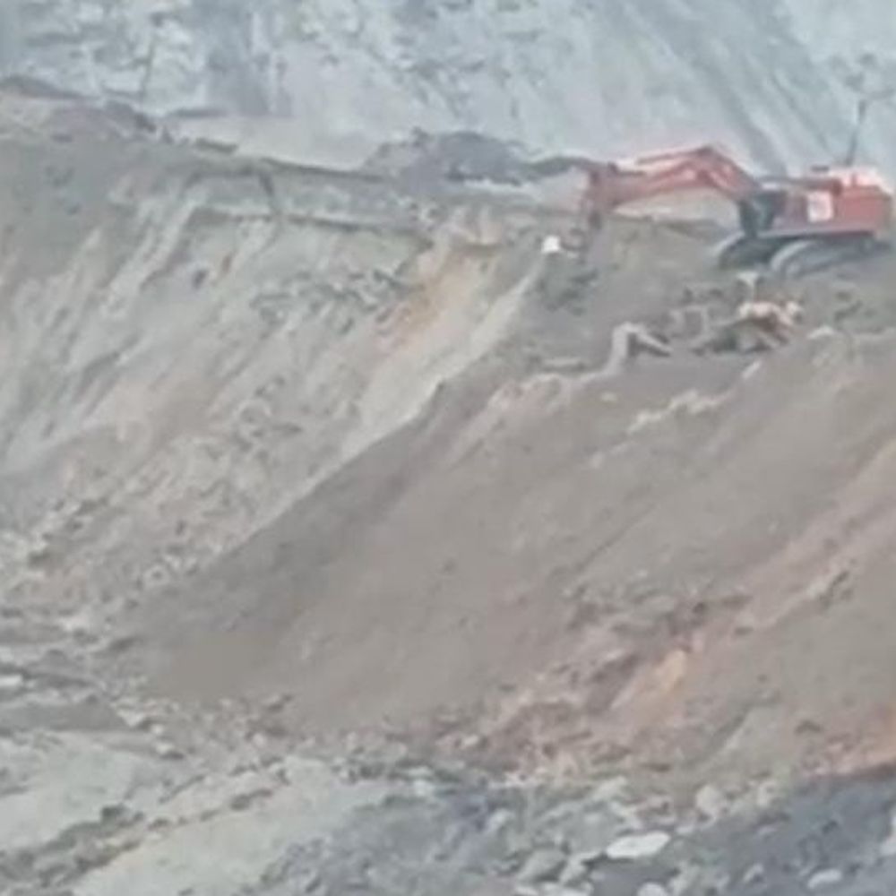 SECL कुसमुंडा में KNRCL कंपनी का 100 टन डंपर पलटा:ऑपरेटर गंभीर घायल, खदान की सुरक्षा पर उठे सवाल