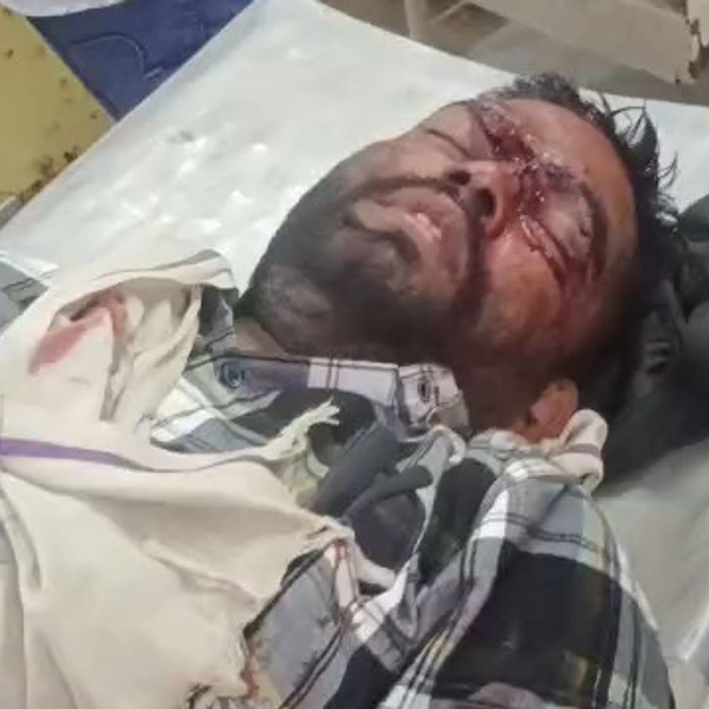 मऊगंज में ट्रक की टक्कर से बाइक सवार घायल:पटेहरा में हादसा, दुकान बंद कर घर लौट रहा था,  प्राथमिक इलाज के बाद रीवा रेफर