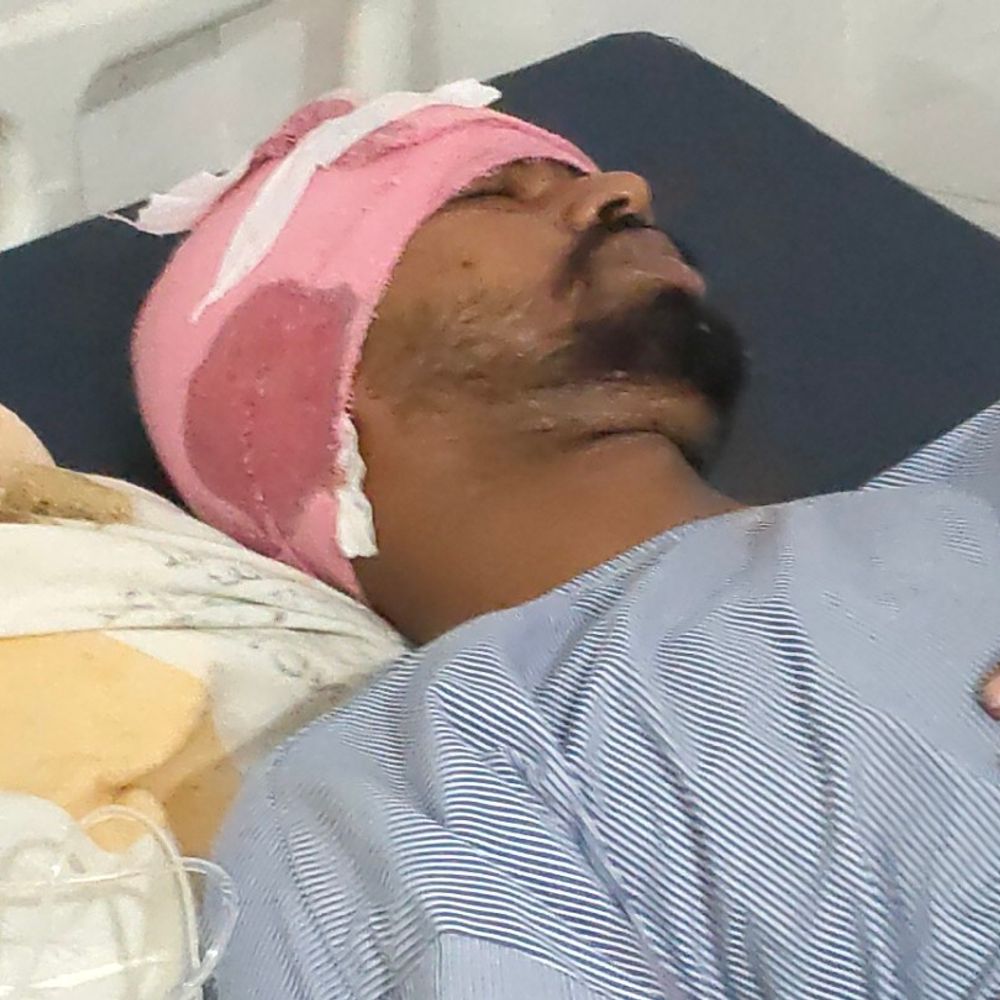 पूर्णिया में दुर्गापूजा मेला में युवक को 3 गोलियां मारीं:एक कनपटी में लगी; घायल अररिया का रहने वाला, पुराने विवाद में गोली मारने का आरोप