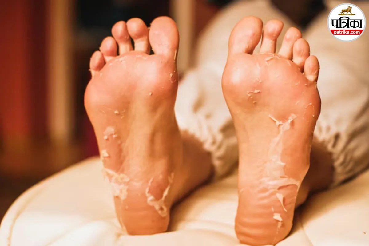 पैरों की रूखी और मोटी त्वचा को मुलायम बना सकता है Foot Peel Mask? जानिए कैसे करें इस्तेमाल