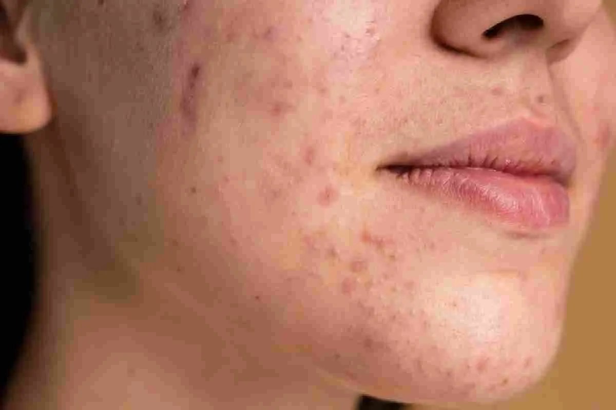 Cosmetic products: 18-30 साल के लोग सावधान ! ‘फेसवॉश- सनस्क्रीन’ से खराब हो रही स्किन, जानें एक्सपर्ट राय
