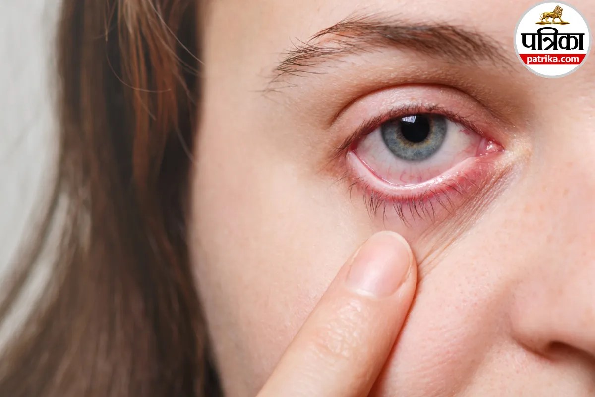 Glaucoma का खतरा जानने के लिए क्यों जरूरी है आंखों का Pachymetry Test? मेयो क्लिनिक से जानें जरुरी बात