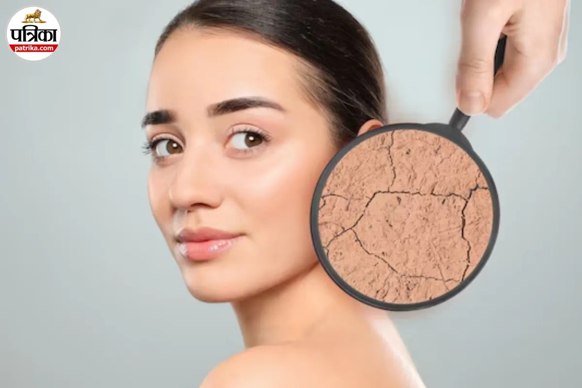 सर्दियों में स्किन को रूखा होने से बचाना है तो न करें ये गलतियां, Cleveland Clinic से जानें स्किन केयर टिप्स