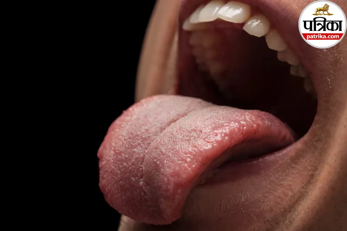 Tongue Color and Liver Disease: जीभ का रंग और बनावट दे सकते हैं लिवर की बीमारियों के संकेत, वैरीवेल हेल्थ से जानें बचने के उपाय