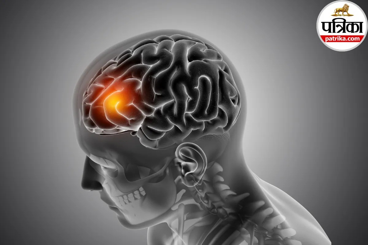 World Stroke Day 2026: अचानक बोलने में लड़खड़ाहट या शरीर के एक तरफ कमजोरी, मेयो क्लिनिक से जानें स्ट्रोक में हर मिनट क्यों है जरूरी?
