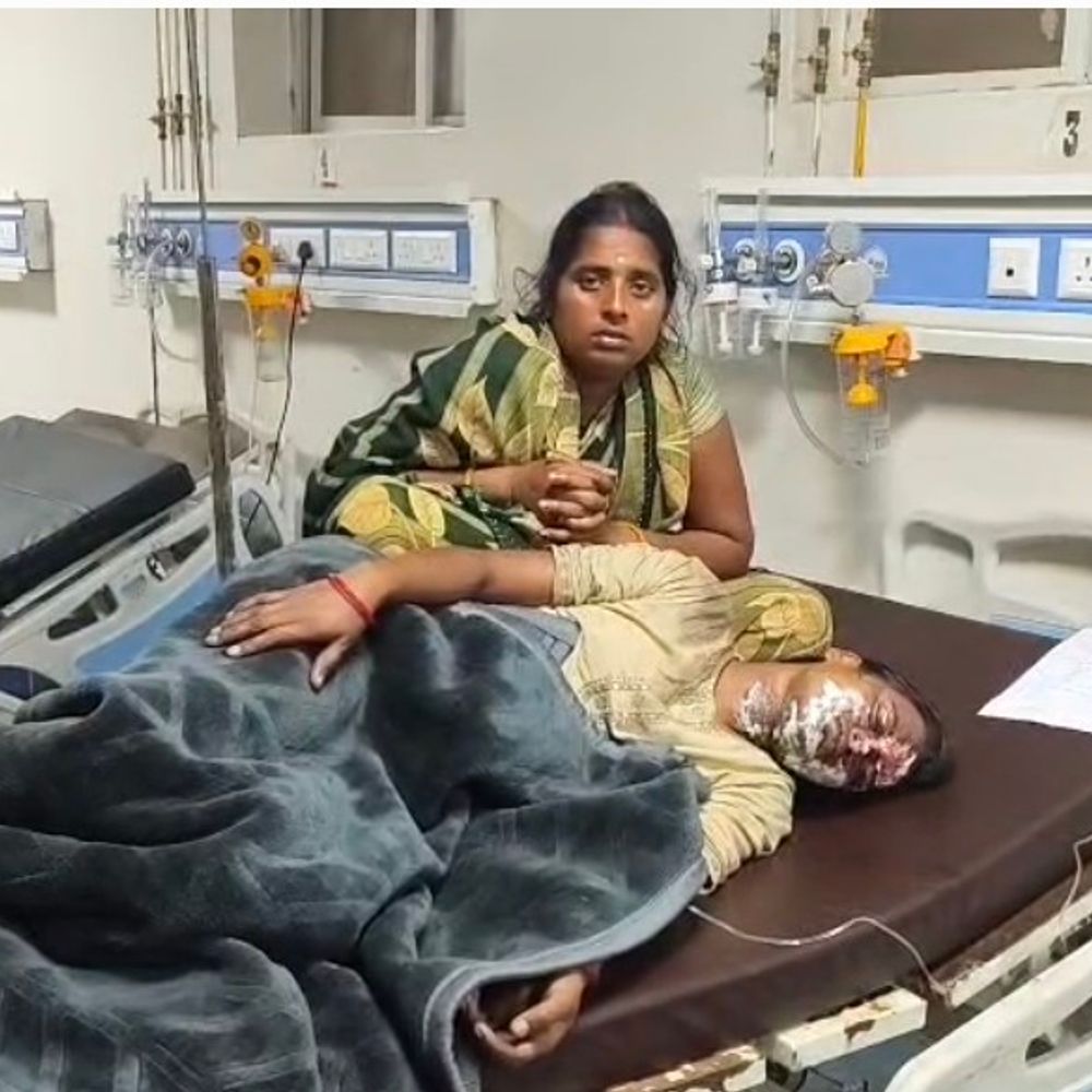 कटनी में खाना बनाते समय प्रेशर कुकर फटा:सलैया सिहोरा में महिला का चेहरा जला; धमाके की आवाज सुनकर पहुंचे परिजन