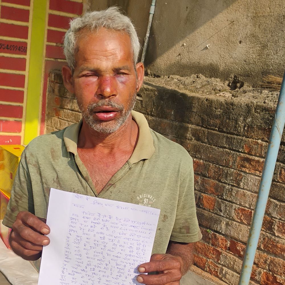 मेले से लाई मिठाई मांगी तो बेटे ने पिता को पीटा, दांत भी तोड़ डाला
