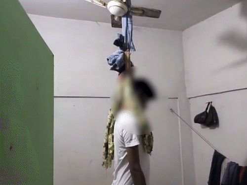 कटिहार में मेडिकल स्टूडेंट ने किया सुसाइड:किराए के कमरे में फंदे से लटका मिला शव, पहले सेमेस्टर में फेल होने से था परेशान