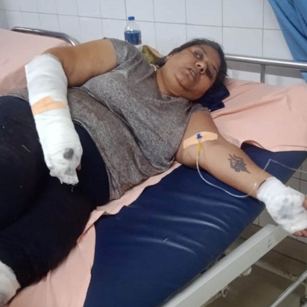बठिंडा में महिला पर तलवारनुमा हथियार से हमला, FIR नहीं:भाई से विवाद के बाद महिला पर तीन वार करने का आरोप; 5 दिन बाद भी केस दर्ज नहीं