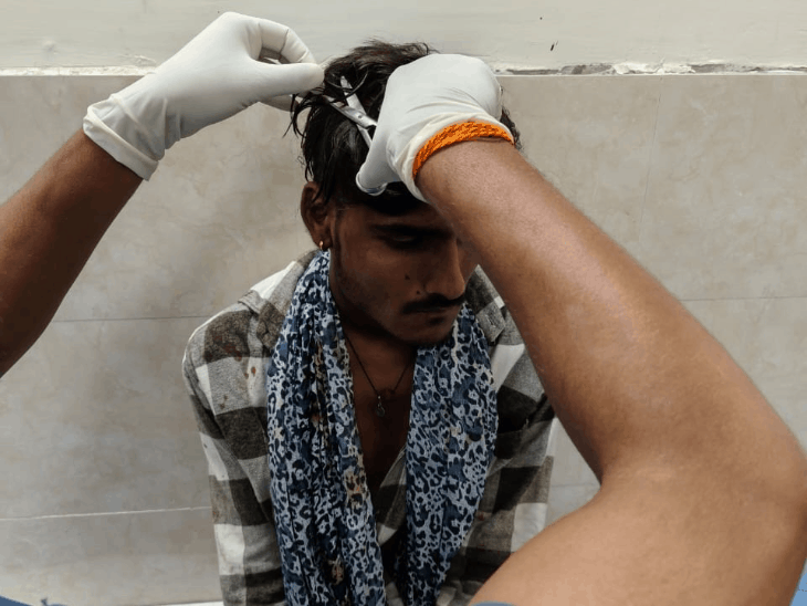 बारां में माता रानी की झांकी के दौरान पथराव:मामूली बात पर विवाद बढ़ा; एक युवक घायल, अस्पताल में भर्ती