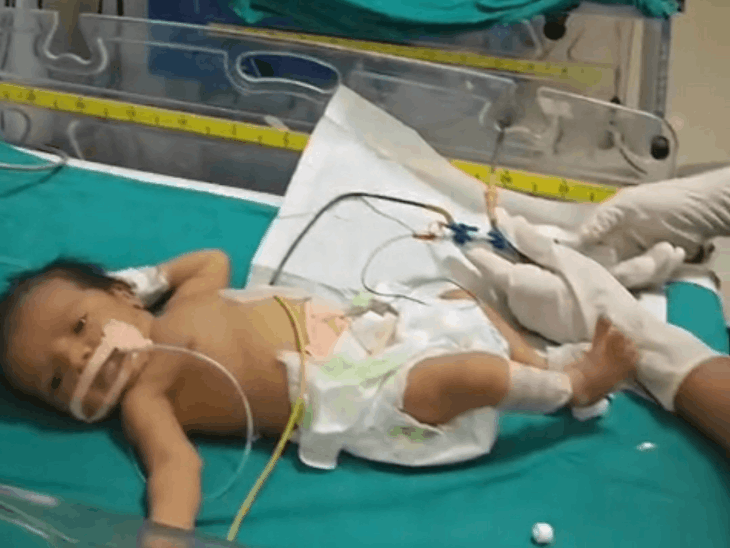 बूंदी में 1 दिन के मासूम को मिला नया जीवन:जन्म के कुछ घंटों बाद ही पीला पड़ने लगा था शरीर, 2 लोगों ने खून देकर बचाई जान