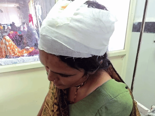 छतरपुर में भैंस पर विवाद, महिला पर फरसे से हमला:सिर में लगे 14 टांके, अस्पताल में भर्ती; 3 लोगों पर आरोप, जांच शुरू