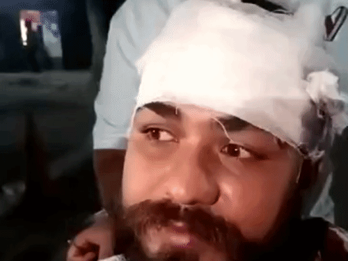 जालंधर में रेहड़ी वाले पर हमला:अंडे-चिकन विक्रेता पर छुरी और चाकू से हमला, पीड़ित ने मांगी प्रशासन से न्याय की गुहार